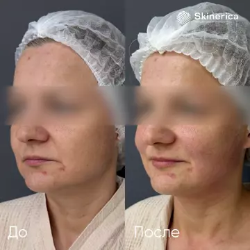 Результат 3