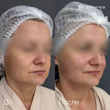 Результат 2