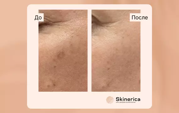 Результат 1