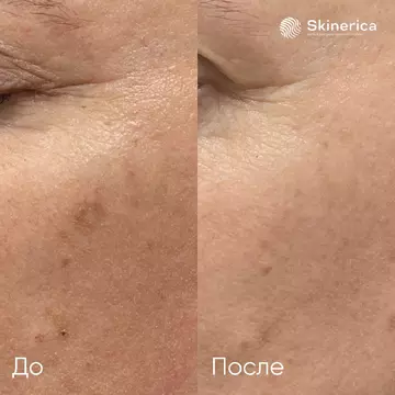 Результат 1