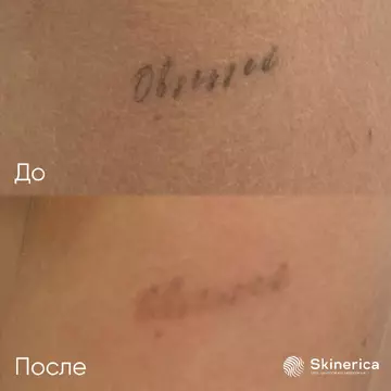 Результат 1
