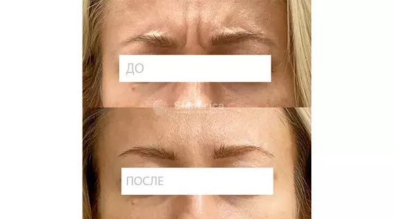 Результат 9