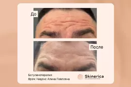 Алина Ниденс 12