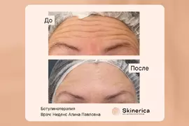 Алина Ниденс 8