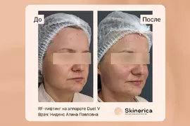 Алина Ниденс 3
