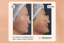 Алина Ниденс 4