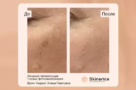 Алина Ниденс 10