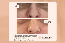 Алина Ниденс 13