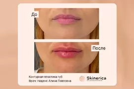 Алина Ниденс 16