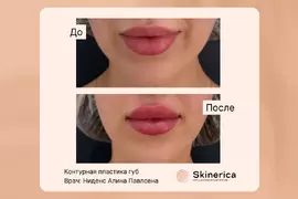 Алина Ниденс 17